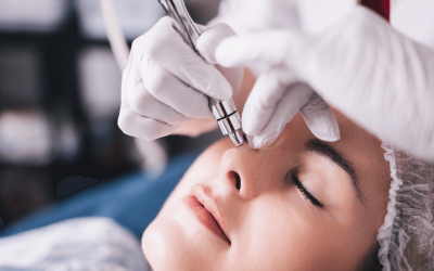 Melasma Treatments: Your Treatment Options Explained